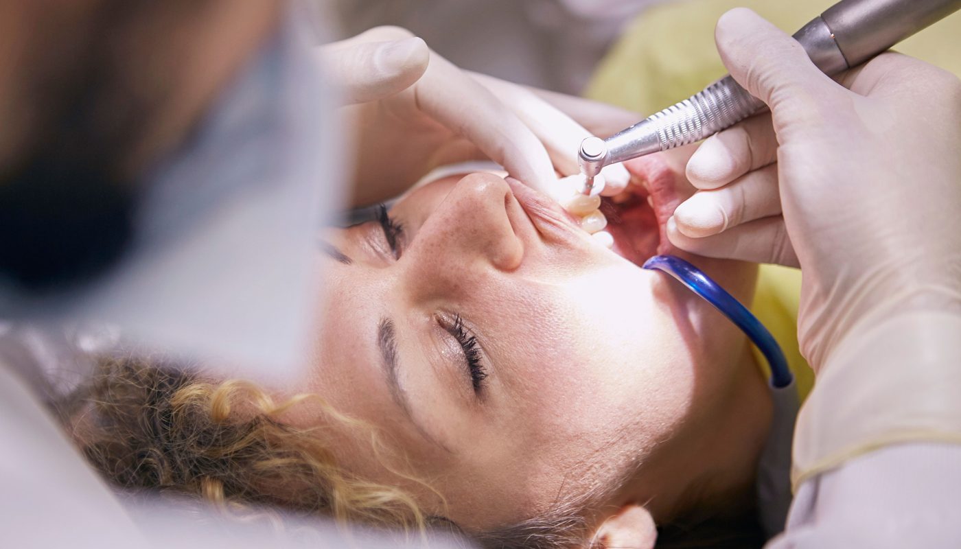 Zahnärztliche Füllungstherapie an einer Patientin