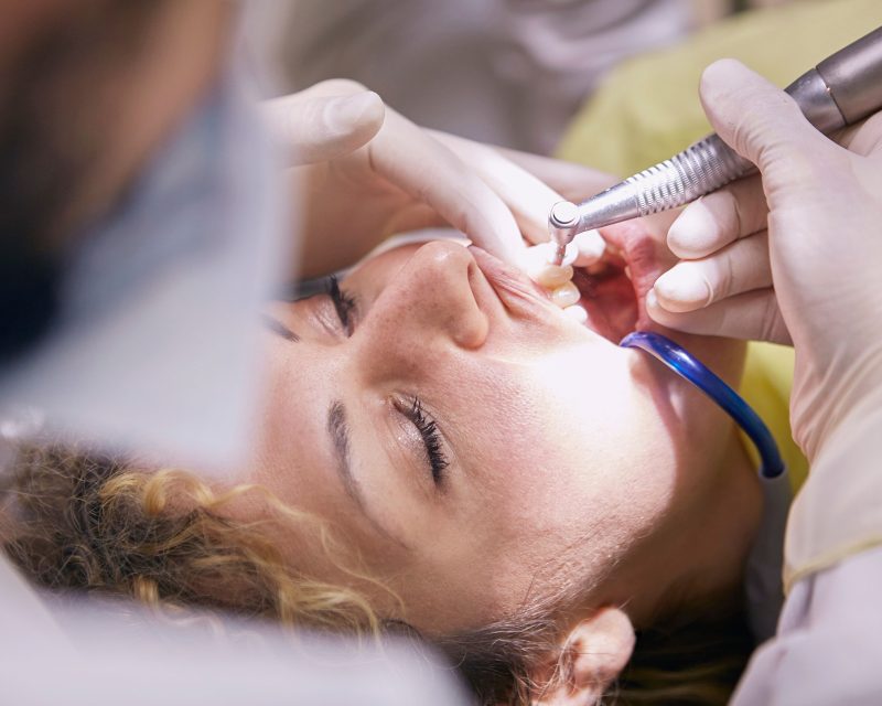 Zahnerhaltung & Füllungstherapie